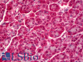 Anti-PTPN22 / PEP Antibody (clone 1A6) IHC-plus LS-B6396
