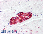 Anti-S100 Protein Antibody IHC-plus LS-B47