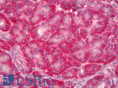 Anti-CCN3 / NOV Antibody (clone 2G8) IHC-plus LS-B6407