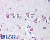 Anti-IREB2 / IRP2 Antibody (aa100-200) IHC-plus LS-B48