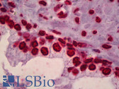 Anti-TARBP2 / TRBP2 Antibody (clone 1D9) IHC-plus LS-B6418