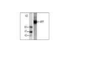 Anti-AFP / Alpha Fetoprotein Antibody IHC-plus LS-B6424