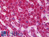 Anti-SDHB Antibody (aa1-150) IHC-plus LS-B6428