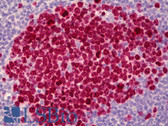 Anti-MKI67 / Ki67 Antibody (clone Ki-S5) IHC-plus LS-B6433