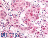 Anti-E2F1 Antibody (phospho-Ser364) IHC-plus LS-B52