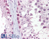 Anti-MRE11A / MRE11 Antibody IHC-plus LS-B6456