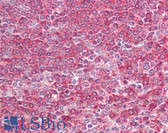 Anti-MD-1 / LY86 Antibody (aa112-125) IHC-plus LS-B6457