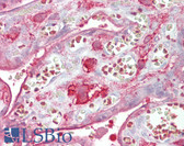 Anti-DAB2 Antibody (C-Terminus) IHC-plus LS-B6461
