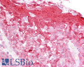 Anti-CSTB / Cystatin B / Stefin B Antibody (C-Terminus) IHC-plus LS-B6463
