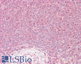 Anti-VPS45 Antibody (Internal) IHC-plus LS-B6464