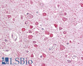 Anti-CEBPG / CEBP Gamma Antibody (C-Terminus) IHC-plus LS-B6470