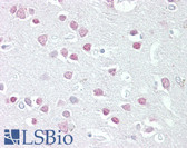 Anti-MC5R / MC5 Receptor Antibody (N-Terminus) IHC-plus LS-B6471