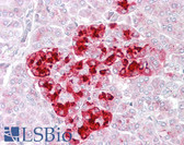 Anti-IGFBP7 / TAF Antibody (Internal) IHC-plus LS-B6473