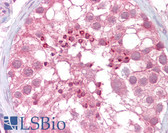 Anti-USP28 Antibody (Internal) IHC-plus LS-B6475