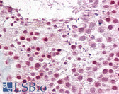 Anti-SUMO2 + SUMO3 Antibody IHC-plus LS-B6481