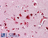 Anti-MAPK14 / p38 Antibody IHC-plus LS-B6490