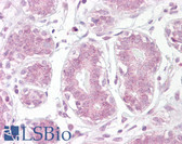 Anti-NFKBIA / IKB Alpha / IKBA Antibody (aa34-48) IHC-plus LS-B6500