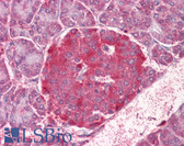 Anti-NOD1 Antibody (aa930-949) IHC-plus LS-B6506