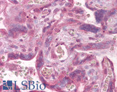 Anti-PLK1 / PLK-1 Antibody (aa100-200) IHC-plus LS-B6508