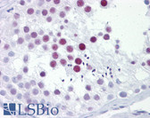 Anti-PHOX2A Antibody (aa72-121) IHC-plus LS-B6514