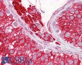 Anti-RTN4 / Nogo Antibody (aa14-30) IHC-plus LS-B6516