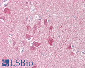 Anti-UCHL1 / PGP9.5 Antibody (aa50-100) IHC-plus LS-B6518