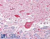 Anti-TIGAR Antibody (aa220-270) IHC-plus LS-B6520