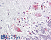 Anti-TIGAR Antibody (aa140-190) IHC-plus LS-B6521