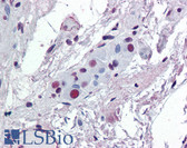 Anti-ATF2 Antibody (clone 4A3) IHC-plus LS-B6524