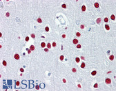 Anti-TUB / Tubby Antibody (aa144-193) IHC-plus LS-B6532