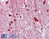 Anti-ZEB2 Antibody (aa36-85) IHC-plus LS-B6533
