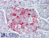 Anti-PCSK1 Antibody (aa683-732) IHC-plus LS-B6536