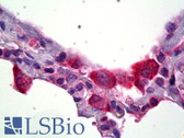 Anti-HSD11B1 / HSD11B Antibody IHC-plus LS-B6547