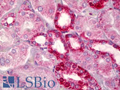 Anti-BCL2 / Bcl-2 Antibody (aa46-95) IHC-plus LS-B6548
