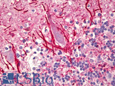 Anti-Neurofilament Antibody (Phosphorylated) IHC-plus LS-B6570