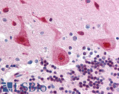 Anti-FANCA Antibody (aa995-1009) IHC-plus LS-B70