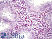 Anti-HMG1 / HMGB1 Antibody (aa131-180) IHC-plus LS-B6586