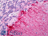 Anti-ACVRL1 Antibody (aa196-245) IHC-plus LS-B6587