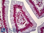 Anti-HNRPA1 / HnRNP A1 Antibody (aa51-100) IHC-plus LS-B6588