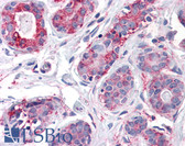 Anti-ENTPD2 Antibody (Internal) IHC-plus LS-A8326