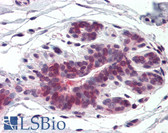 Anti-HELO1 / ELOVL5 Antibody (Internal) IHC-plus LS-A8398