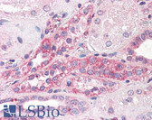 Anti-C14orf1 Antibody (C-Terminus) IHC-plus LS-A8848