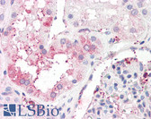 Anti-C14orf1 Antibody (Internal) IHC-plus LS-A8850