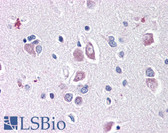 Anti-DLL1 Antibody (aa155-173) IHC-plus LS-B72