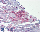 Anti-Junctin / ASPH Antibody (aa107-156) IHC-plus LS-B6602