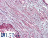 Anti-KCNMA1 / BK Antibody (aa1080-1129) IHC-plus LS-B6604
