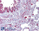 Anti-GABRB3 Antibody (aa180-229) IHC-plus LS-B6606