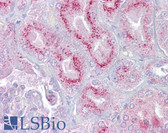 Anti-P2RX2 / P2X2 Antibody (aa108-157) IHC-plus LS-B6608