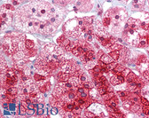 Anti-ARC / Arg3.1 Antibody (aa287-336) IHC-plus LS-B6612