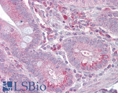 Anti-SLC13A2 / NaCT Antibody (aa360-409) IHC-plus LS-B6629